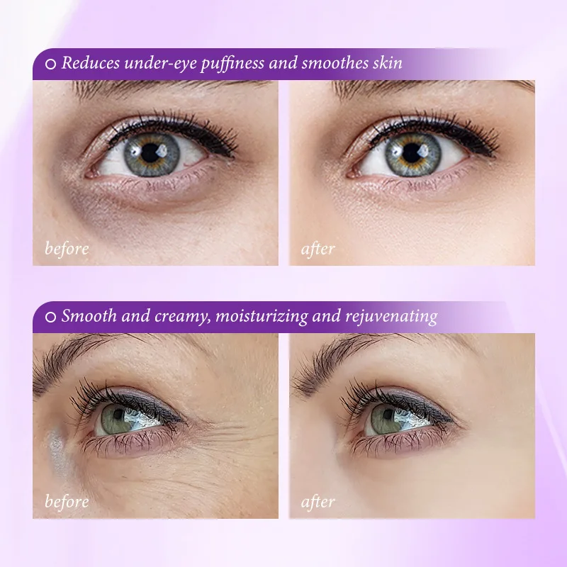 Instant Eye Bag Removal Cream  - Retinol Anti Wrinkle Cream recension och pris