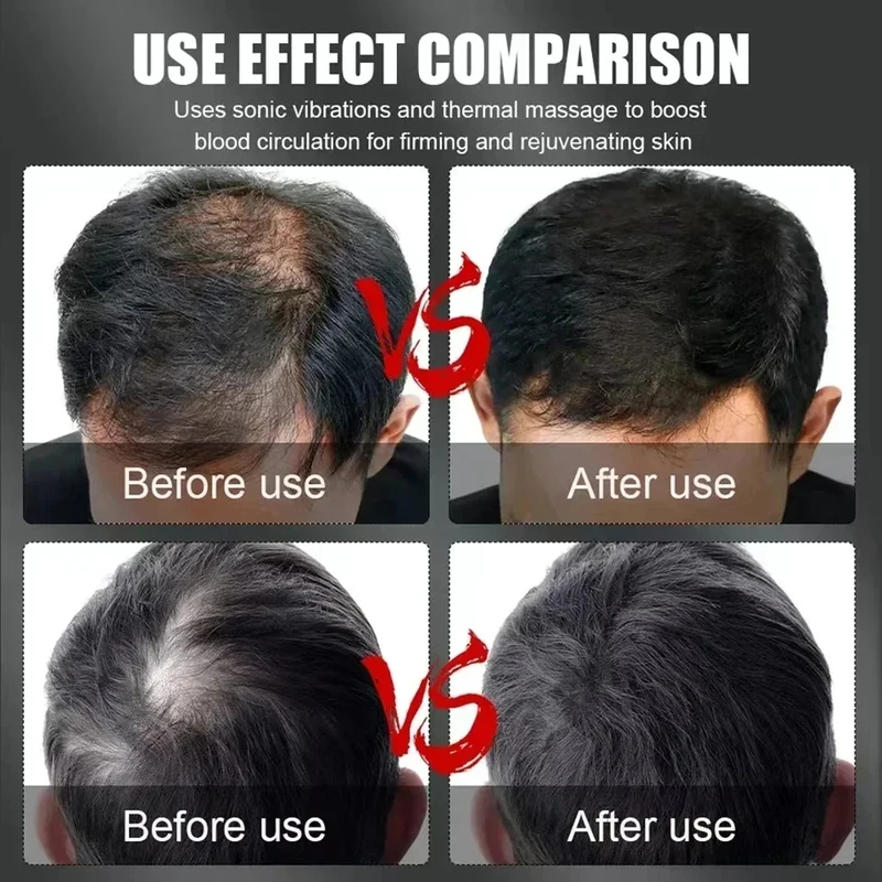 660nm 850nm Red Light Infrared - Hair Care recension och pris